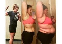 Fat Loss Breakthrough: Embracing the Power of Gut Microbiome